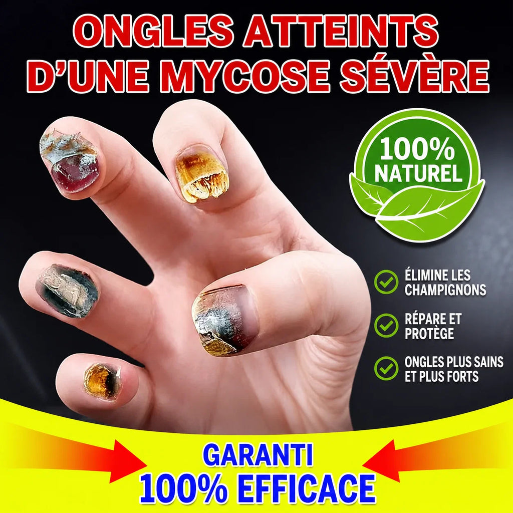 Patchs contre les mycoses d'Ongles – Révélez la beauté de vos ongles
